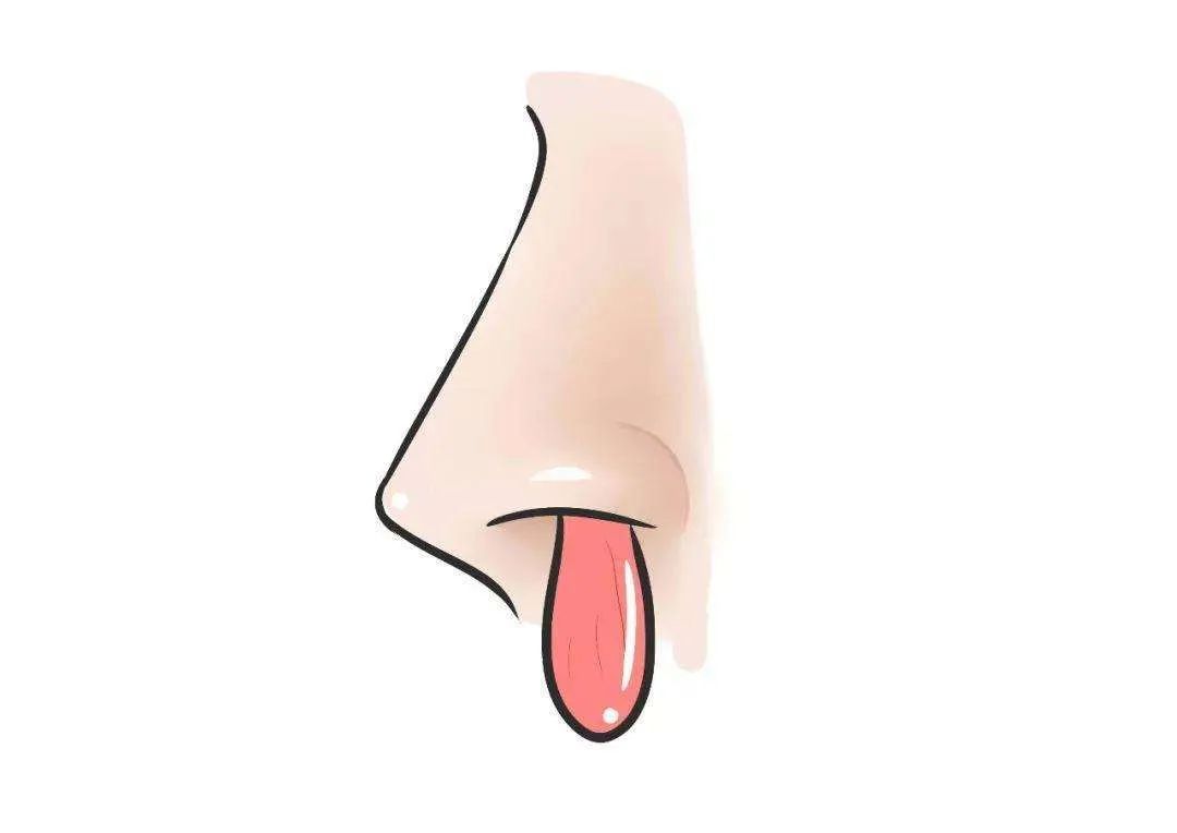 科普 | 鼻出血可不是小問題，科學(xué)治療最重要