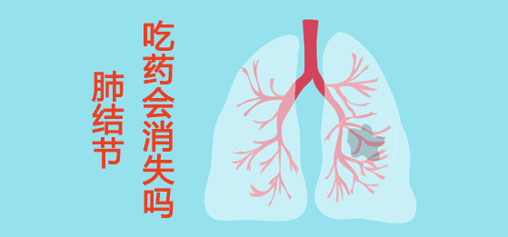 肺結(jié)節(jié)吃藥可以消失嗎？