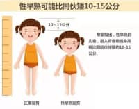 孩子長(zhǎng)不高、性早熟，免費(fèi)測(cè)骨齡來(lái)啦！骨齡儀免費(fèi)檢測(cè)義診！
