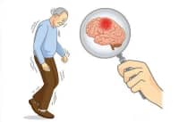 數(shù)九寒天，如何預(yù)防卒中發(fā)生？要牢記這5點……