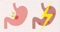 出現(xiàn)多食、易饑等情況？要及時進(jìn)行這3種原發(fā)病的篩查