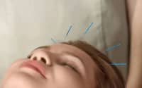 秋季到，鼻炎鬧，得了鼻炎怎么辦？中醫(yī)：改善體質(zhì)是關(guān)鍵！